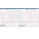 INTERMED ELETTROCARDIOGRAFO DIGITALE INTERPRETATIVO 12 DERIVAZIONI A 12 CANALI SU BASE PERSONAL COMPUTER-ECG2000